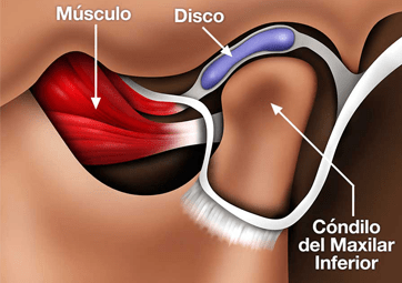 Articulación temporomandibular: disfunción, causas, tratamiento y  prevención